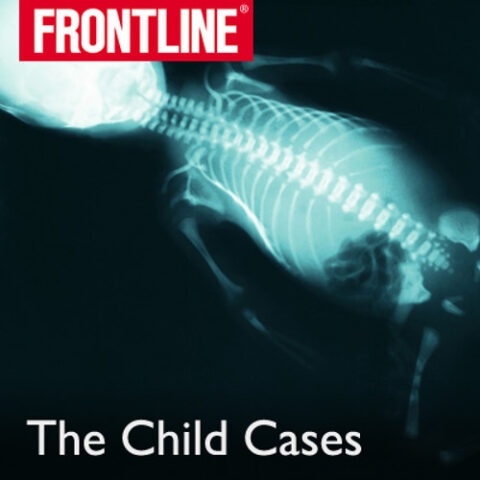 The image features the PBS FRONTLINE logo in red and white at the top left corner. Below it is an X-ray of a child's torso. The text "The Child Cases" airs in white at the bottom of the image.