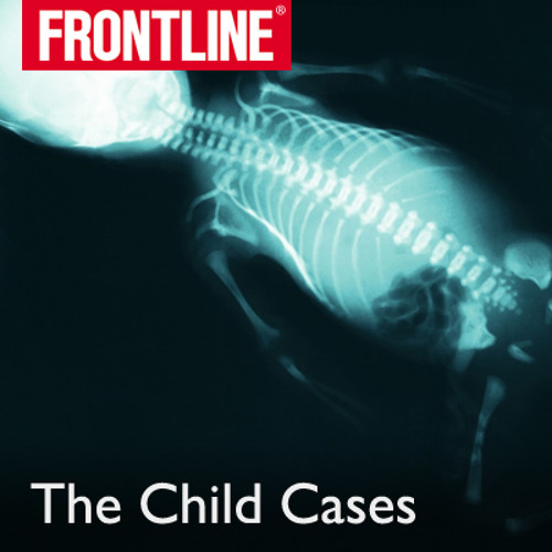 Poster states, "Frontline, The Child Cases." There is an x-ray of a baby. 